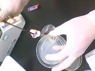 環氧乙烷滅菌殘留量